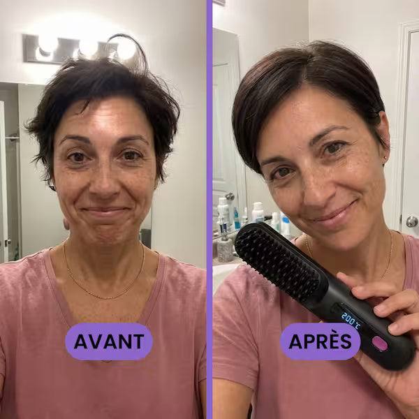 Brosse miracle